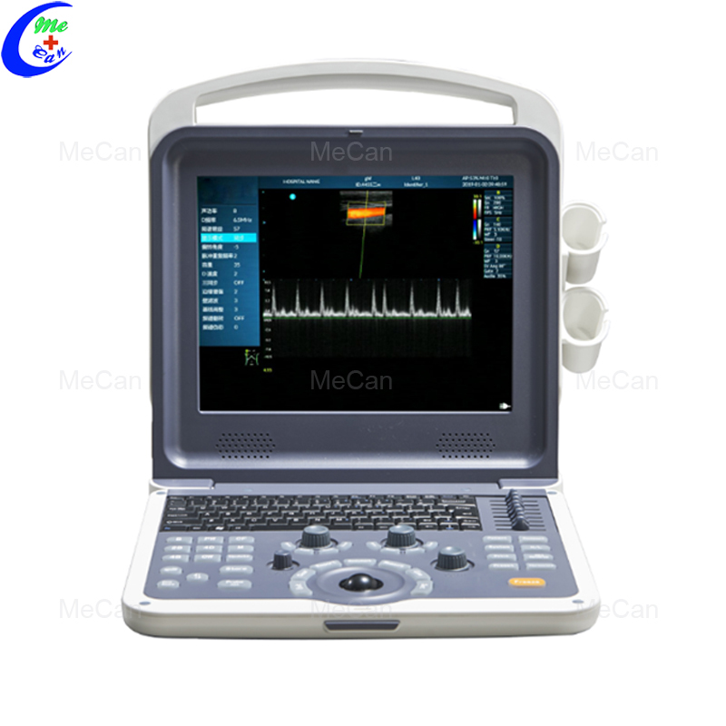 Kulur Doppler Ultrasound Skaner fiċ-Ċina Manifattura u Fornitur