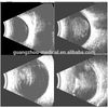 Portable AB Scanner: Ophthalmesch Ultraschall Imaging