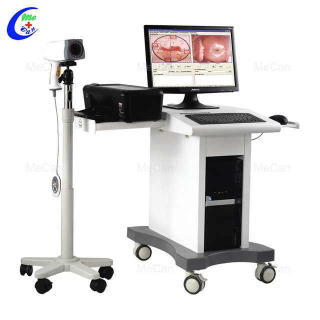 Kalidad High Quality Trolley Digital HD Video Colposcope para sa Gynecology Manufacturer | MeCan Medical