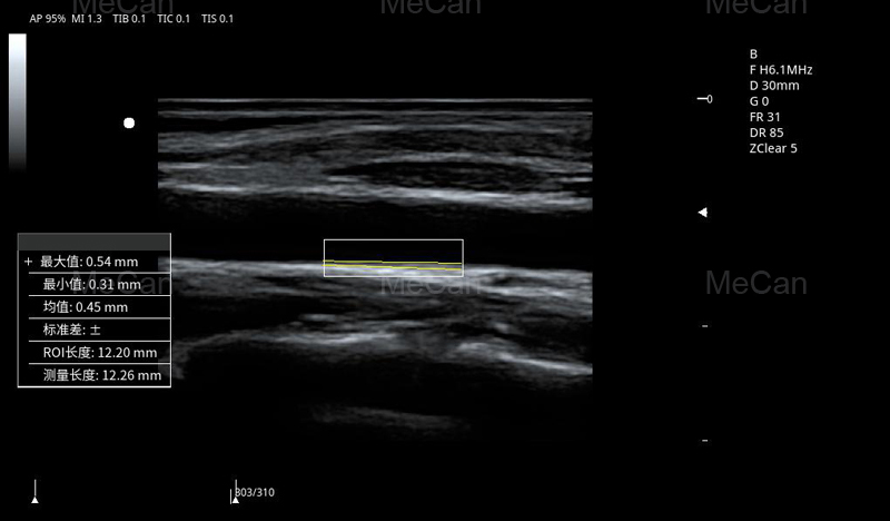 test imaging of More information of 4D Ultrasound Machine