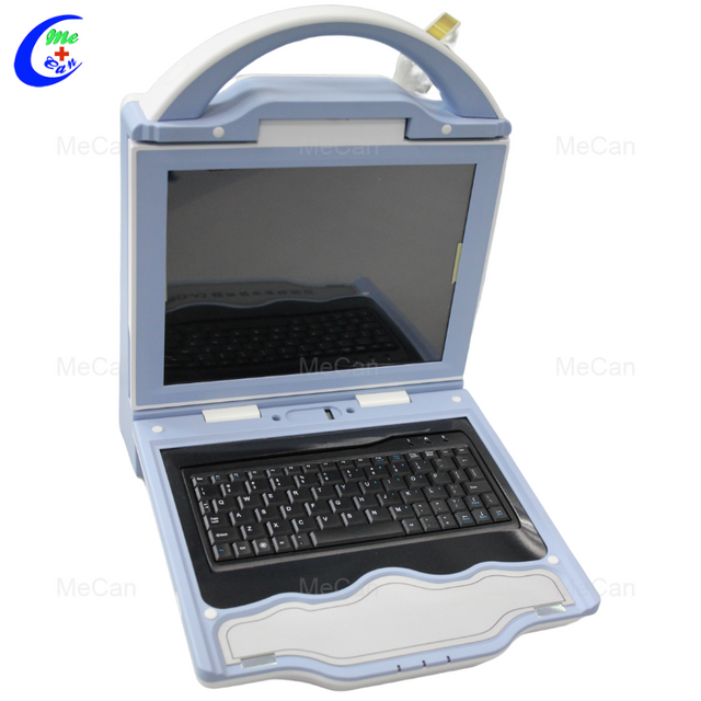 አውቶማቲክ ከፍተኛ ውጤታማ የአልትራሳውንድ አጥንት Densitometer