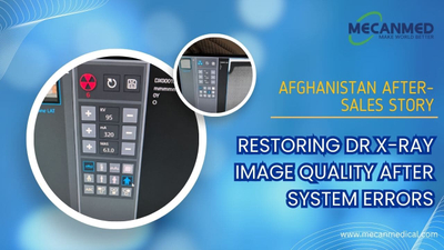 mimu-pada sipo-dr-x-ray-image-quality-after-system-errors.jpg