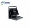 SonoScape E1 Portable S / W Ultraschall Maschinn